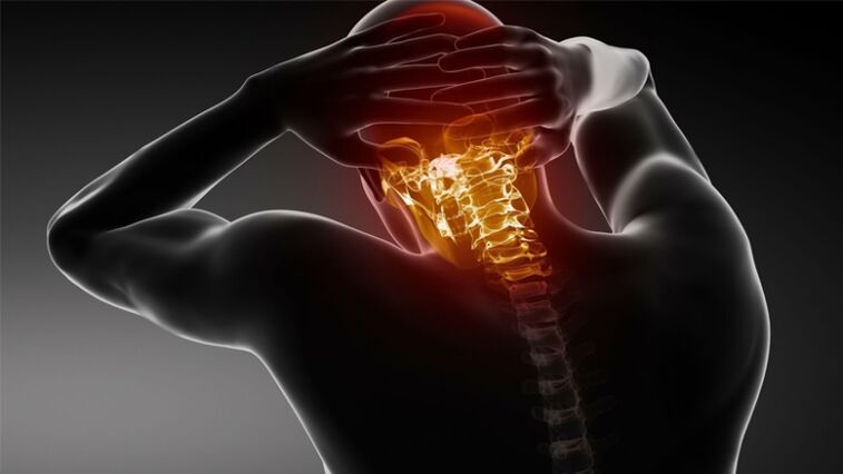 Douleur à l'arrière de la tête avec ostéochondrose cervicale
